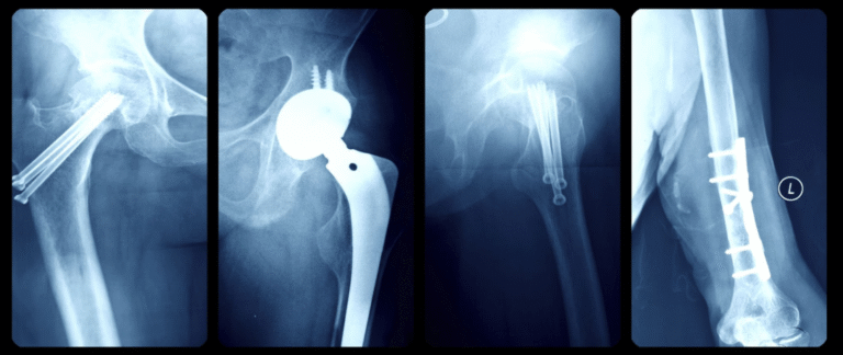 Replacement as the Future of Healthy Aging